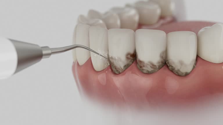 Reliable Dental contractor in Paul, ID by Smile Center Dentistry